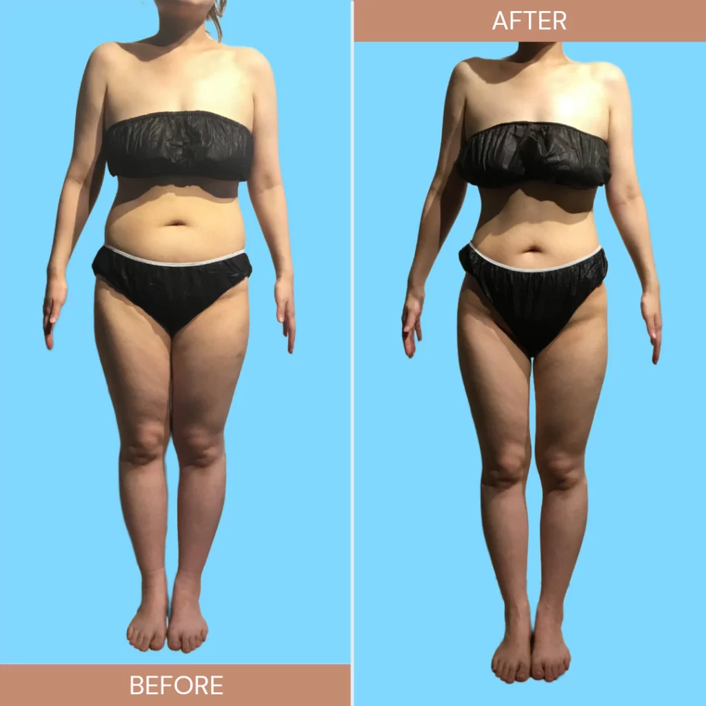 産後太りを解消したママの衝撃なBefore⇒After