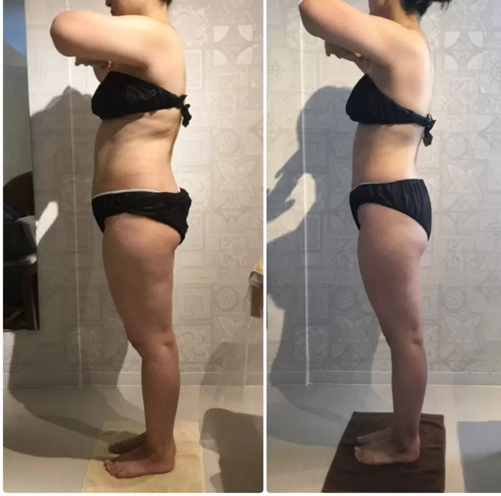 息子さんの卒業式のためにダイエットを決意して3ヶ月後はどうなった?